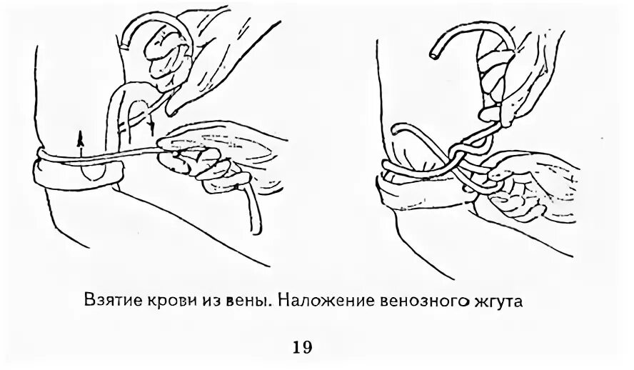 Взятие крови вакуумной системой алгоритм. Забор крови из вены шприцем алгоритм. Взятие крови из вены шприцом алгоритм. Техника забора крови из периферической вены. Техника взятия крови из вены шприцом.