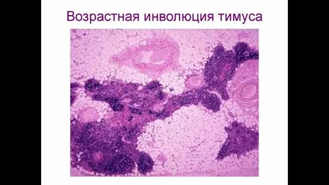 Возраст инволюции
