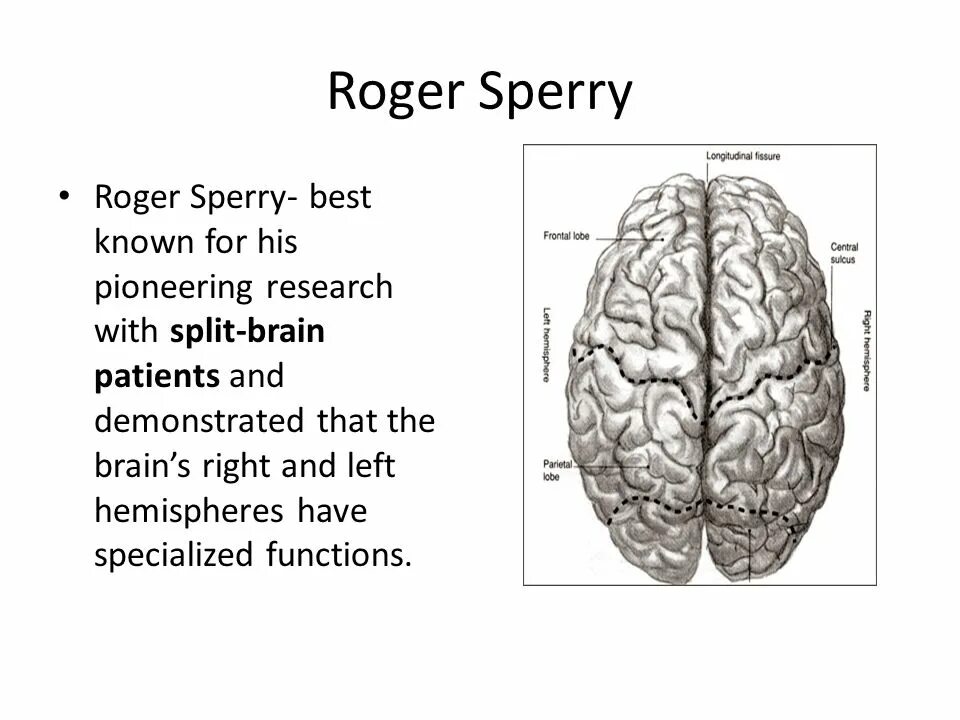 Split brain. Роджер Сперри. Роджер Сперри полушария. Роджер Сперри кошки. Теория Роджер Сперри.