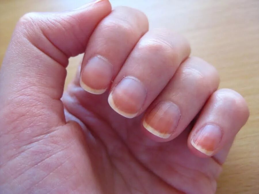 Здоровый цвет ногтей на руках.