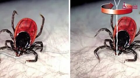 Больно вытаскивать клеща