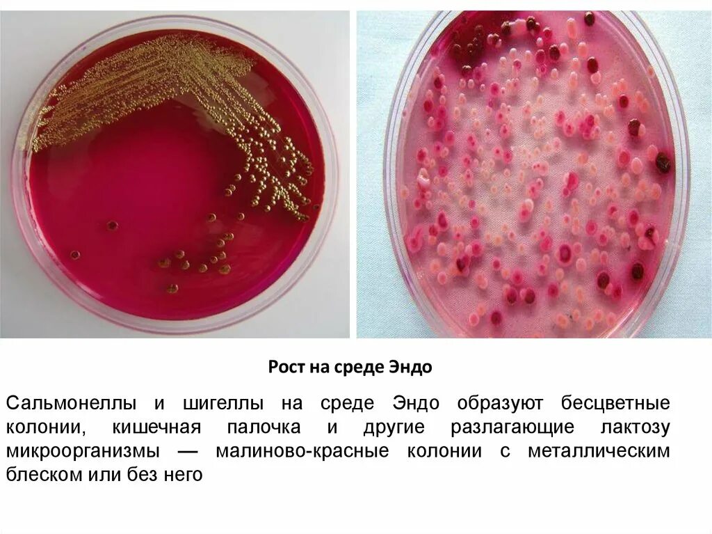 Среда для кишечной палочки. Шигеллы рост на средах Эндо. Пост бактепий на спела Эндо. Рост энтеробактерий на среде Эндо. Рост шигелл на среде Эндо.