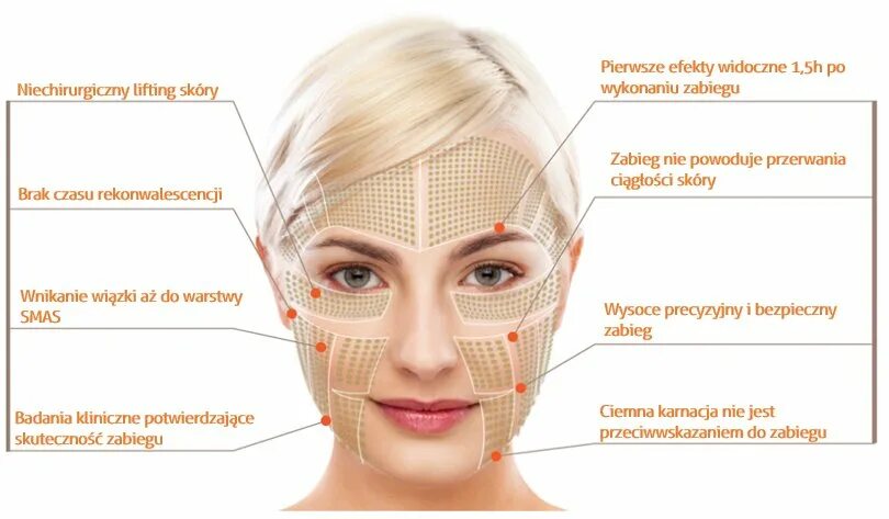 Схема подтяжки лица. Смас лифтинг схема линий. Схема ультразвукового смас лифтинга. Смас подтяжка схема. HIFU smas схема.