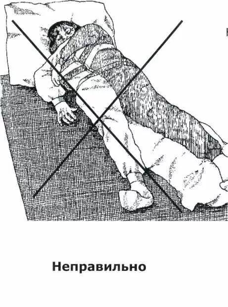 Поставить утку больному. Поставить утку больному