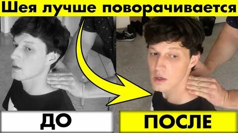 Не поворачивается шея у ребенка