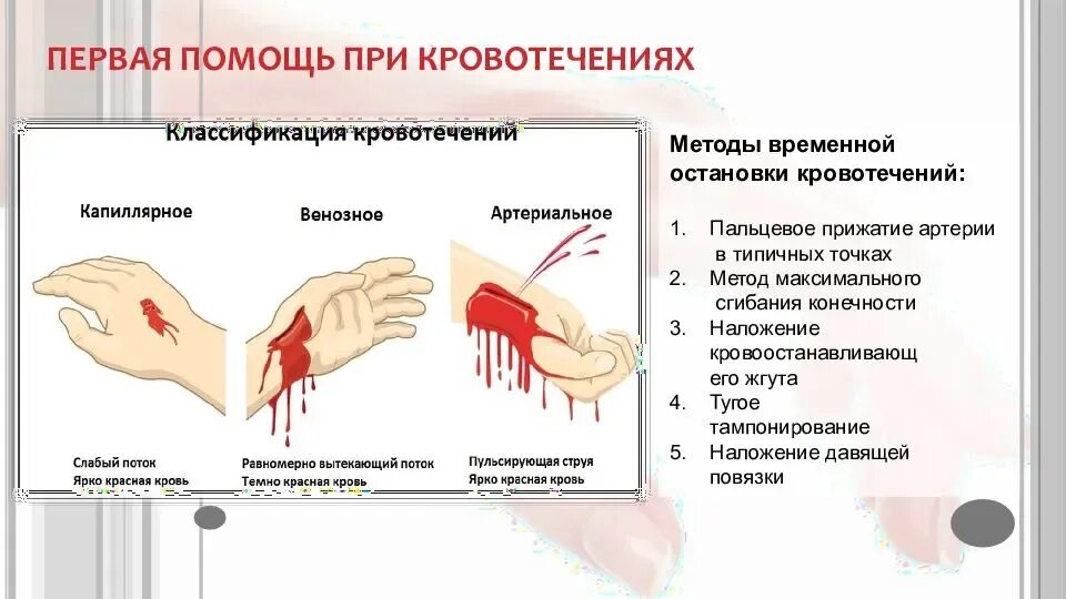 В случаях сильного кровотечения. Методы оказания неотложной помощи при кровотечениях. Памятка по первой помощи при кровотечении. Памятка по оказанию первой помощи при артериальном кровотечении. Схема оказания первой помощи при кровотечениях.