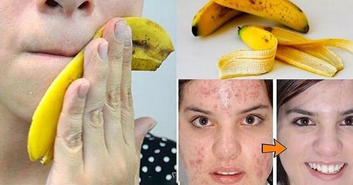 Кожура банана для лица. Банановая шкурка для лица. Кожура от банана. Банановый кожурки для лица.