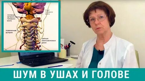 Постоянно шумит в голове причины