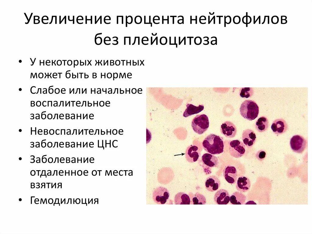 Понижены сегментоядерные нейтрофилы в крови у женщин. Повышенные сегментоядерные нейтрофилы. Сегментоядерные нейтрофилы повышены. Сегментоядерных нейтрофилов повышен. Палочкоядерные нейтрофилы повышение.