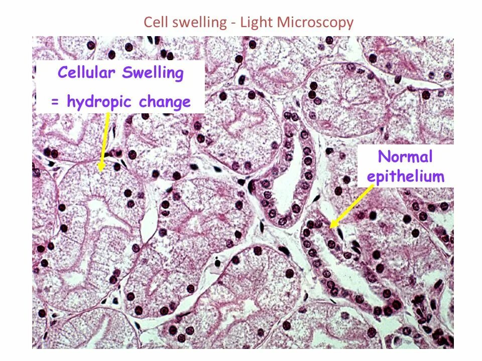 Changing cells. Тельца сиватта гистология. renal tubular epithelial cells. саксена препарат.