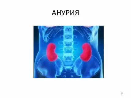 Почечная анурия