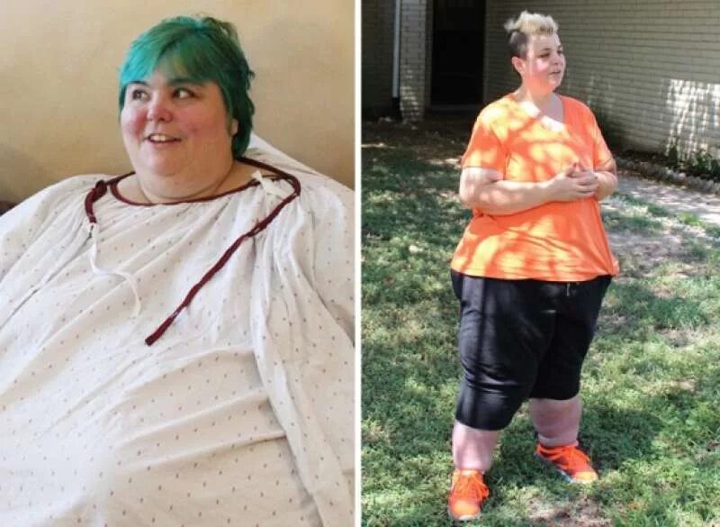 Жирные до и после похудения. Жирные люди до и после похудения. Необычайно толстая
