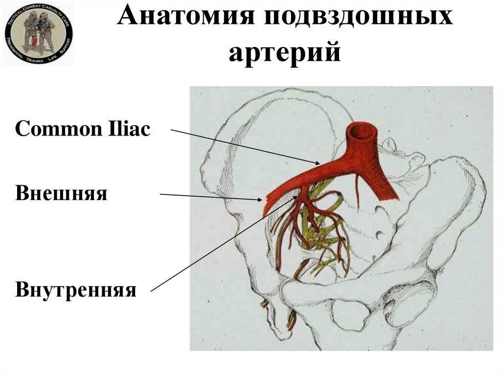 Ветви общей подвздошной артерии схема. Подвздошная артерия анатомия. Подвздошные артерии анатомия схема. Наружная подвздошная артерия.