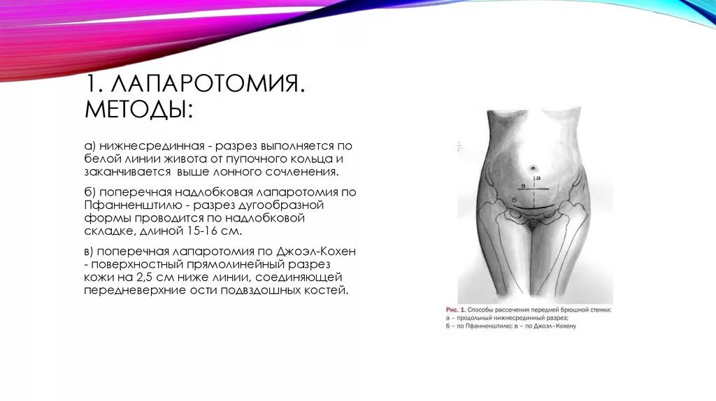 Техника кесарева. Нижне средниеач лапаротомия. Нижнемрединная лапаро.