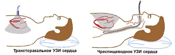 Трансторакальное узи сердца. Эхокардиография сердца трансторакальная. Трансторакальная эхокг методика. Эхо-кг сердца. Трансторакальное узи сердца.
