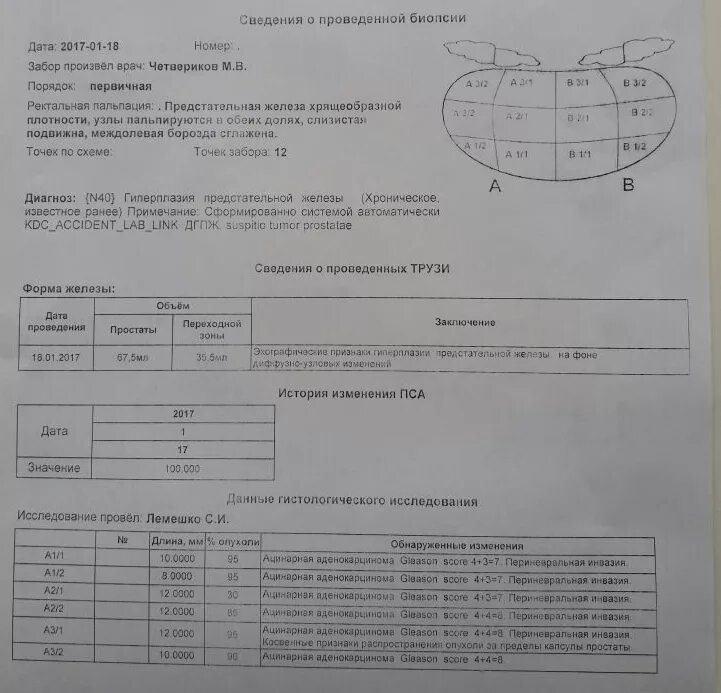 Протокол биопсии предстательной железы. Биопсия простаты заключение. Расшифровка биопсии предстательной железы. Результаты биопсии предстательной железы. Результаты биопсии время