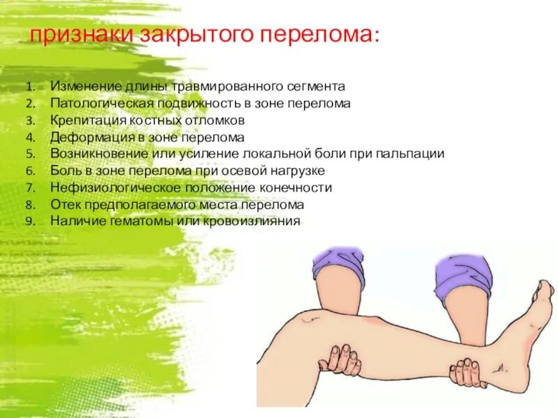 Симптом патологической подвижности. Симптом осевой нагрузки при переломе. симптом осевой нагрузки. симтпомызакрытого перелома. признаки закрытого перелома.