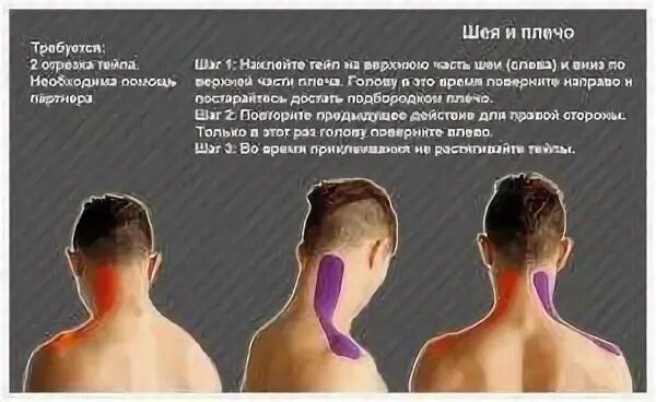 Больно поворачивать и наклонять шею