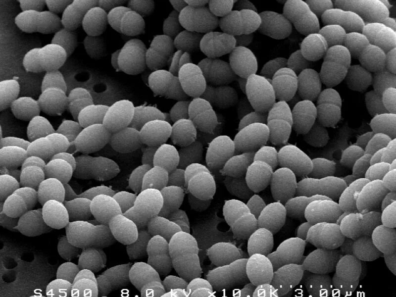 Streptococcus thermophilus. Термофилус стрептококк. streptococcus thermophilus стрептококк термофильный. мезофильные молочнокислые стрептококки. термофильный стрептококк под микроскопом.