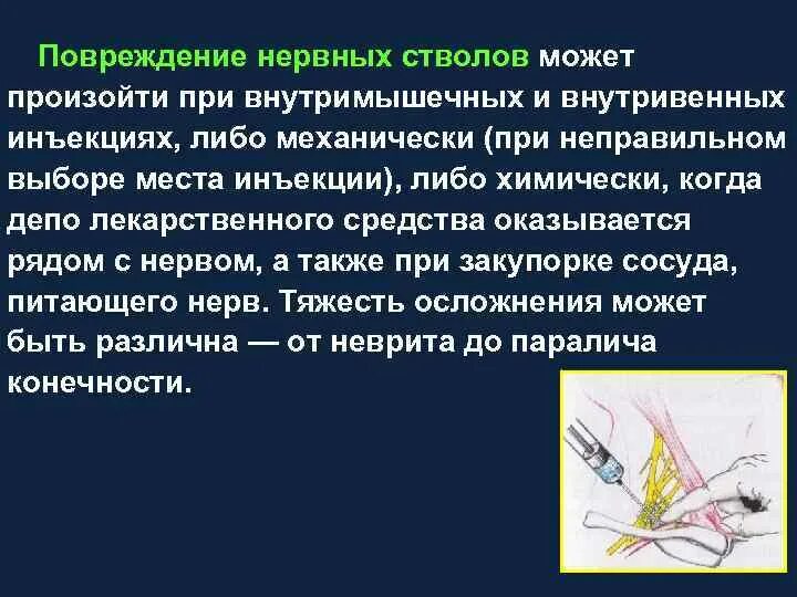 Повреждение нервов, нервных стволов. Повреждение нервных стволов возникает при. Повреждение нервных стволов при инъекции.