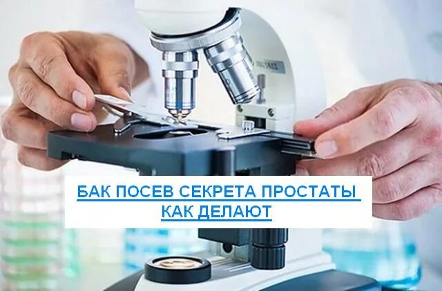 Сдать посев простаты. Бак посев секрета. бак посев сока простаты. бак посев секрета простаты. бак посев секрета простаты как делают.