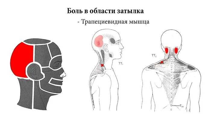 Боли в правой затылочной части