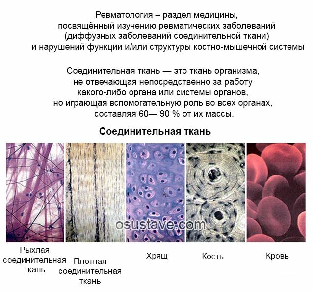 Смешанные заболевания соединительной. Системные заболевания соединительной ткани патоморфология. Патоморфология при системных заболеваниях соединительной ткани. Диффузные заболевания соединительной ткани таблица. Болезни, относящиеся к диффузным заболеваниям соединительной ткани.