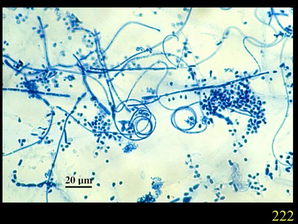 Лептотрикс лечение. Микроскопия Trichophyton rubrum. Trichophyton микроскопия. Грибы кандида микроскопия. Эпидермофития микроскопия.