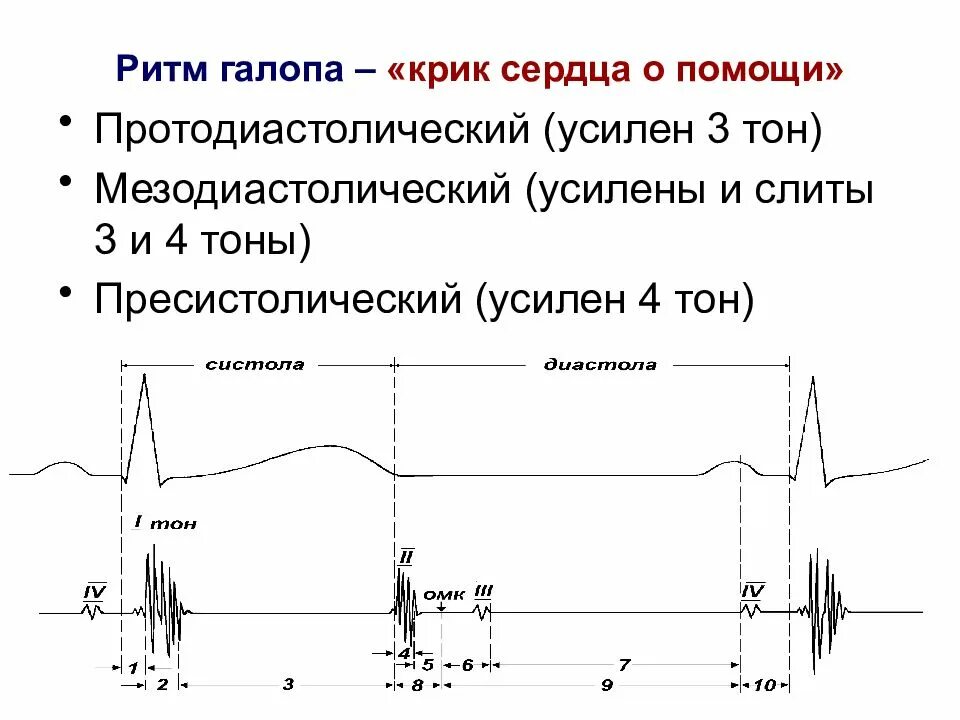 Тоны сердца ритм. Пресистолический галопа ритм экг. механизм возникновения ритма галопа. ритм галопа фонокардиограмма. протодиастолический ритм галопа фкг.