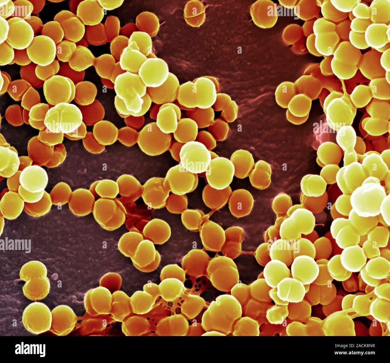 Микроорганизм staphylococcus aureus. Метициллин-резистентный золотистый стафилококк. стафилококк золотистый staphylococcus aureus. s. aureus золотистый стафилококк.