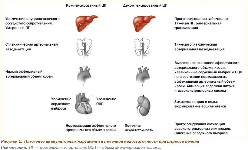 Сердечно печеночная недостаточность. Патогенез цирроза при сердечной недостаточности. Цирроз печени при сердечной недостаточности патогенез. Портальный цирроз печени патогенез. Патогенез увеличения печени при циррозе.