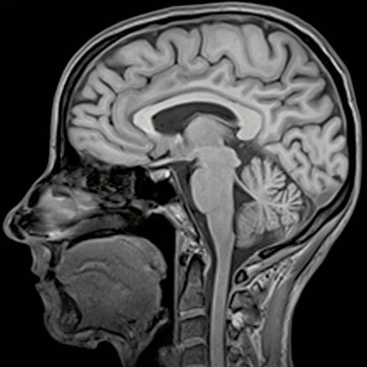 Мрт головного мозга санкт петербург. Магнитно-резонансная томография (мрт) гипофиза. Мрт головного мозга с контрастом норма. Мрт головного мозга (с прицелом на мостомозжечковые углы).