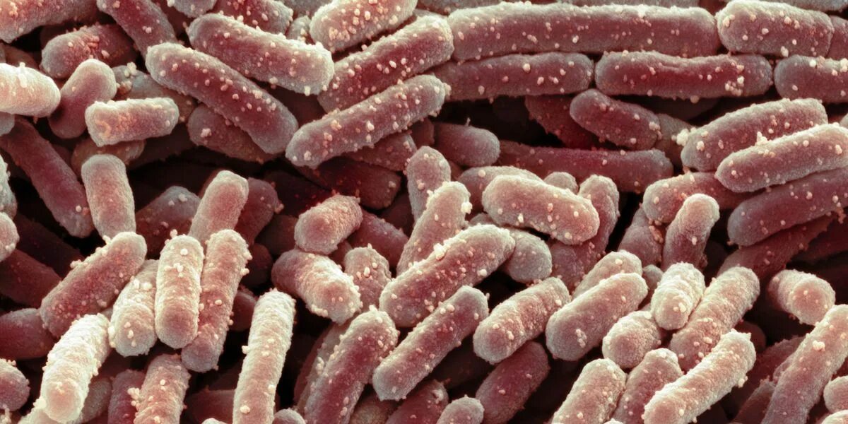 Lactobacillus delbrueckii subsp. Лактобациллы бактерии. Болгарская палочка lactobacillus bulgaricus. Бактерия листерия. Бифидобактерии лонгум.