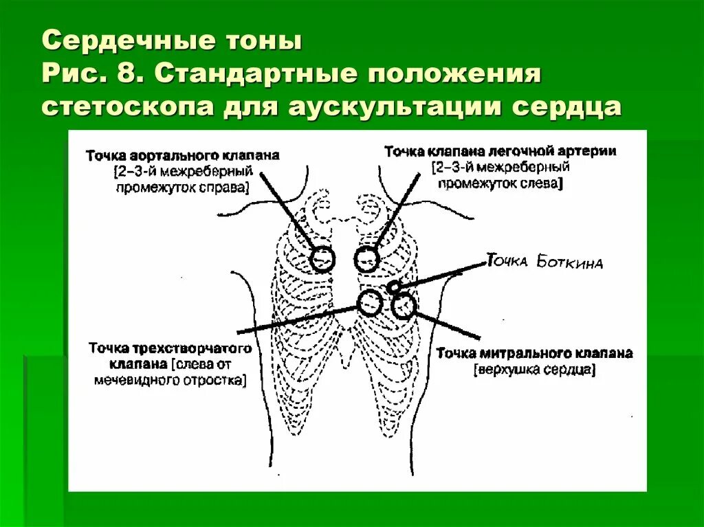 Сердечные тоны шумы. Тоны сердца. Тоны сердца аускультация. Точки аускультации сердца пропедевтика. Точки выслушивания тонов сердца.