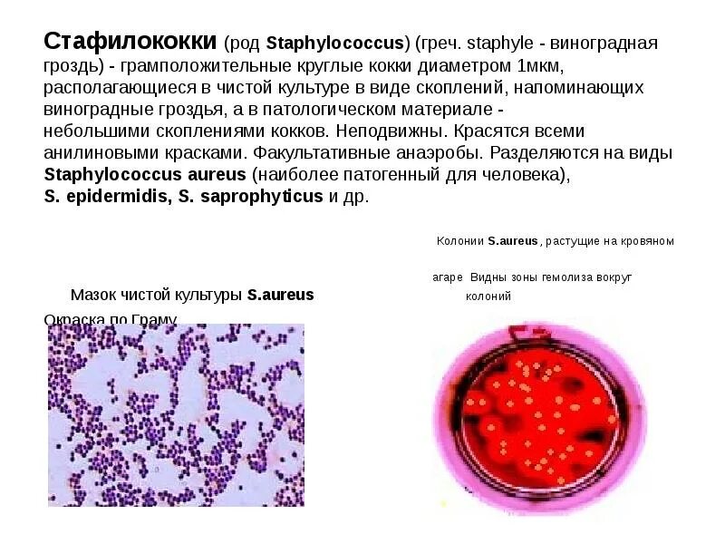 Грамположительные и грамотрицательные бактерии. Кокки диплококки спириллы формы бактерий. Грамположительные кокки. Роды кокков. Стафилококки являются причиной.