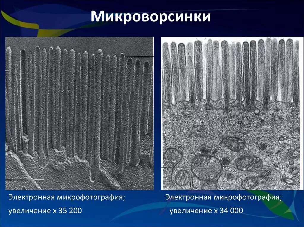 Микроворсинки клетки гистология. Микроворсинки электронная микроскопия. Реснички жгутики микроворсинки микрофотография. Микроворсинки кишечника гистология. Микроворсинки это