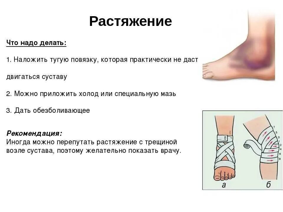 Разрыв мышц признаки. При растяжении сухожилия стопы. Что делать при растяжении мыш.