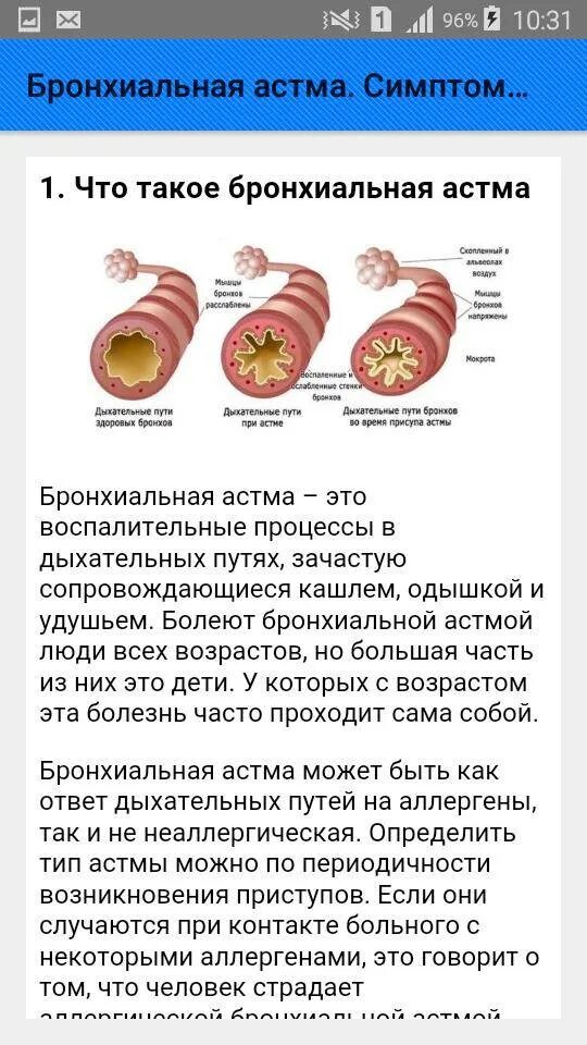 Как проверяют на астму