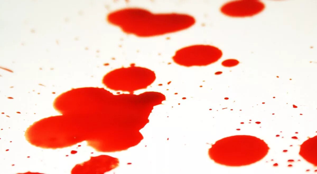 Алая пенистая кровь выделяется при. Ярко красный цвет крови.