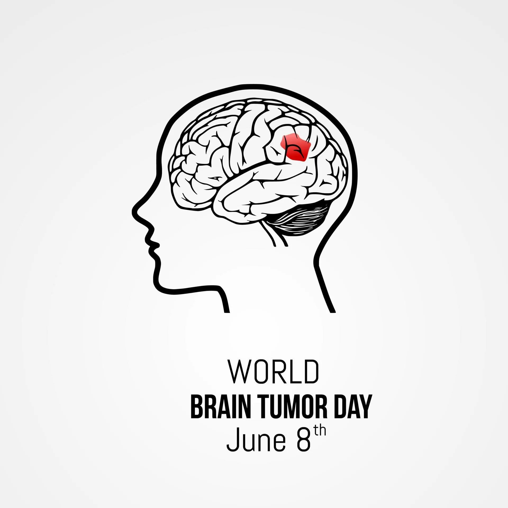 World Brain tumor Day. Всемирный день борьбы с опухолями головного мозга. Тумор Vektor.