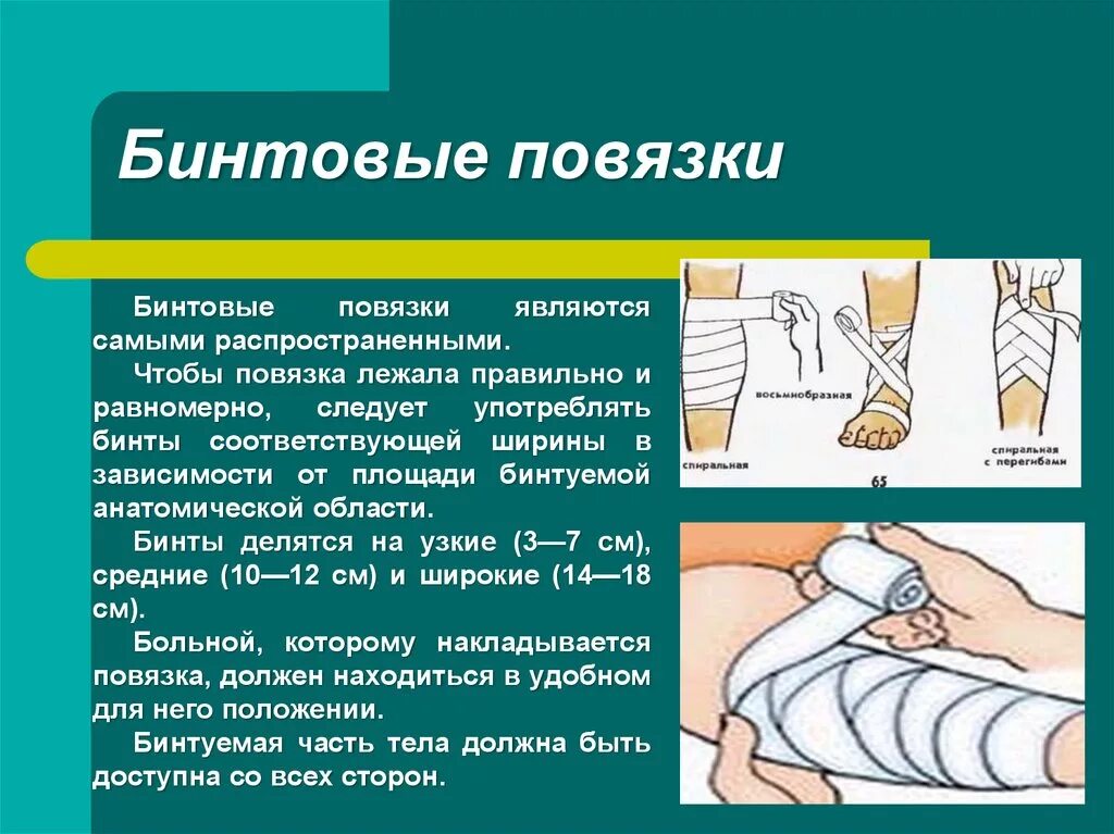 Бинтовая повязка алгоритм. Бинтовые повязки. Бинтовые повязки повязки. Наложение перевязок. Наложение бинтовых повязок.