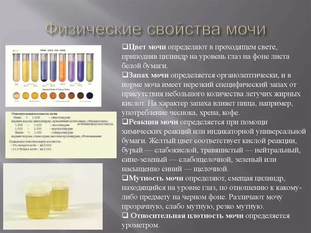 Вытекает моча почему. Цвет и прозрачность мочи. Физические свойства моят. Прозрачность мочи в норме. Цвет мочи при патологии.