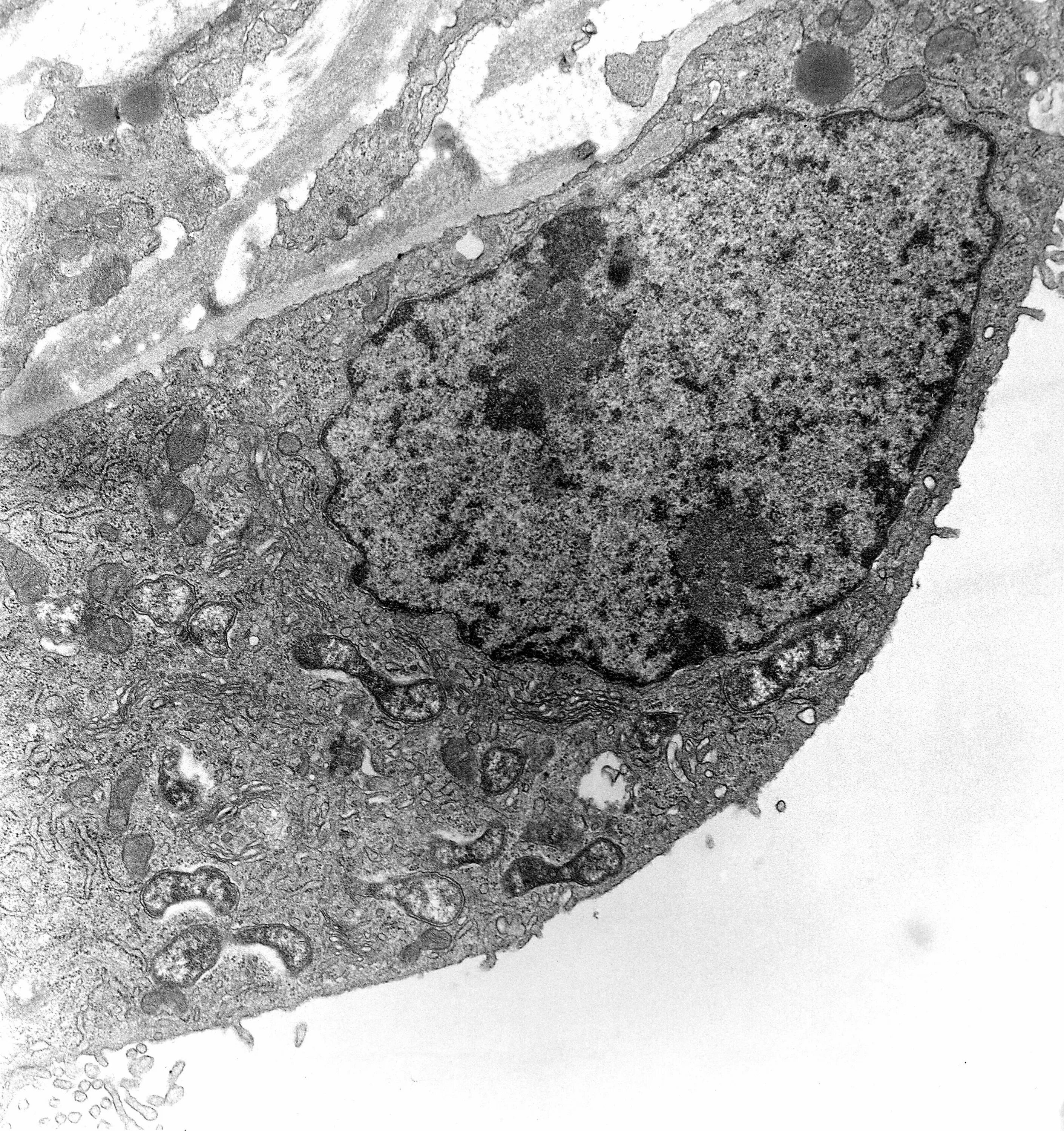 цитоплазма микрофотография. ядро клетки микрофотография. строение ядра клетки микрофотография. клетки печени гепатоциты. цитоплазма микрофотография.