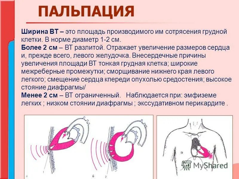пальпация магистральных сосудов сердца. пальпация и перкуссия сердца. пальпация основания сердца. перкуссия сердца при артериальной гипертензии. пальпация и перкуссия сердца.