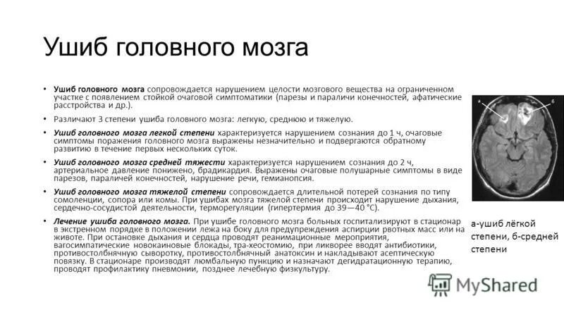 Повреждения головного мозга возникают. Ушиб головного мозга очаговая симптоматика. Ушиб головного мозга очаговые симптомы. Основные признаки ушиба головного мозга. Очаговые симптомы при ушибе головного мозга.