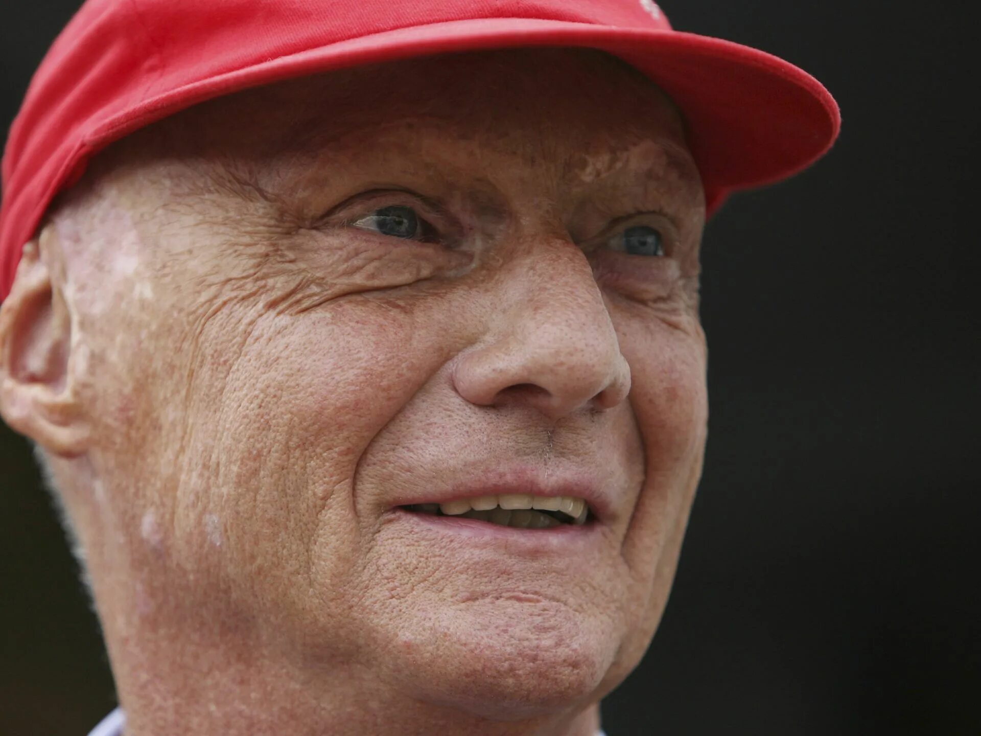 Ники лауда. Лауда после аварии. Ники лауда. Лауда после аварии. Ники лауда фото.