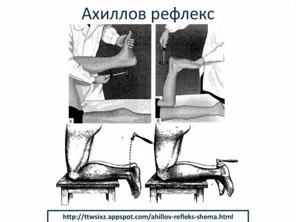 Ахиллов рефлекс