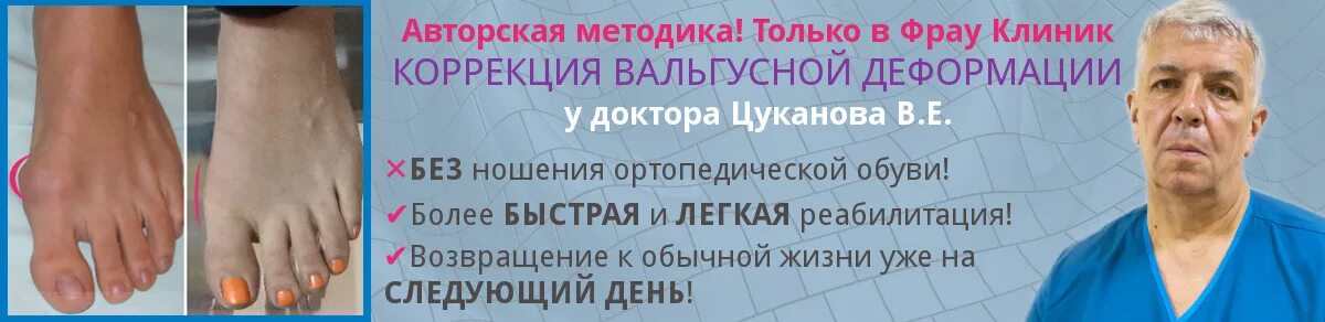 Операция по вальгусной деформации стопы. Операция по устранению косточки на ноге. Операция коррекции вальгусной деформации. Вальгусная операция реабилитация после операции