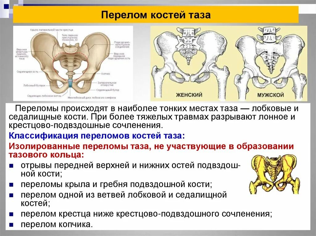 Перелом лонной кости классификация. Перелом лонной и седалищной кости. При переломе лонных костей таза. Перелом нижней ветви лонной кости.