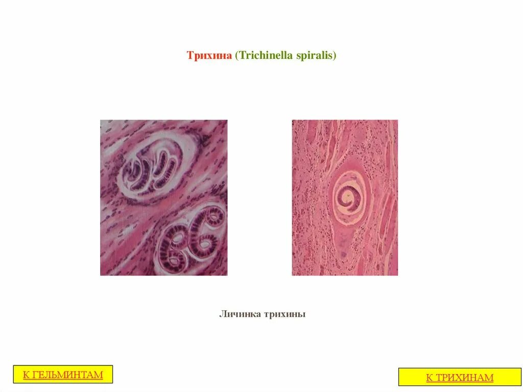 Инкапсулированная личинка трихинеллы строение. Трихинелла (Trichinella spiralis). Инкапсулированные личинки трихинеллы в мышечной ткани. Trichinella spiralis инкапсулированная личинка.